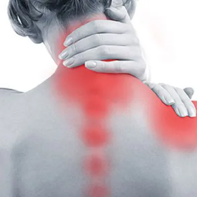 La brachialgia: la “sciatica” del braccio