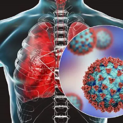 LA FISIOTERAPIA RESPIRATORIA NELLA POLMONITE INTERSTIZIALE POST-COVID.